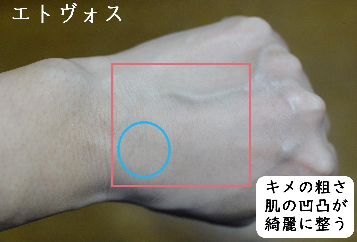 ミネラルファンデーションカバー力_エトヴォス